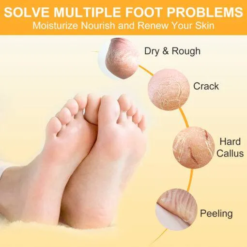 NBC Pedicure Spa Foot Care In A Box 4 Step Set - Tropical Fruit Scent (Clearance)